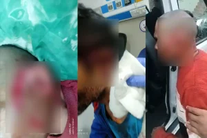 तेंदुए के हमले से 4 से 5 लोग घायल, वन विभाग की टीम अभी तक नाकाम