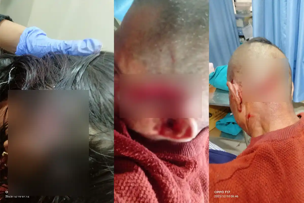 Leopard Attack: तेंदुए के हमले से 4 से 5 लोग घायल, वन विभाग की कोशिशें जारी