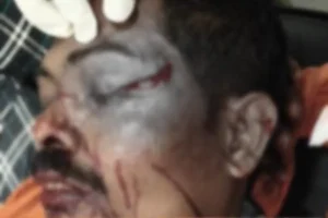 हिंगोली शहर में घातक चीनी मांजे से एक घायल