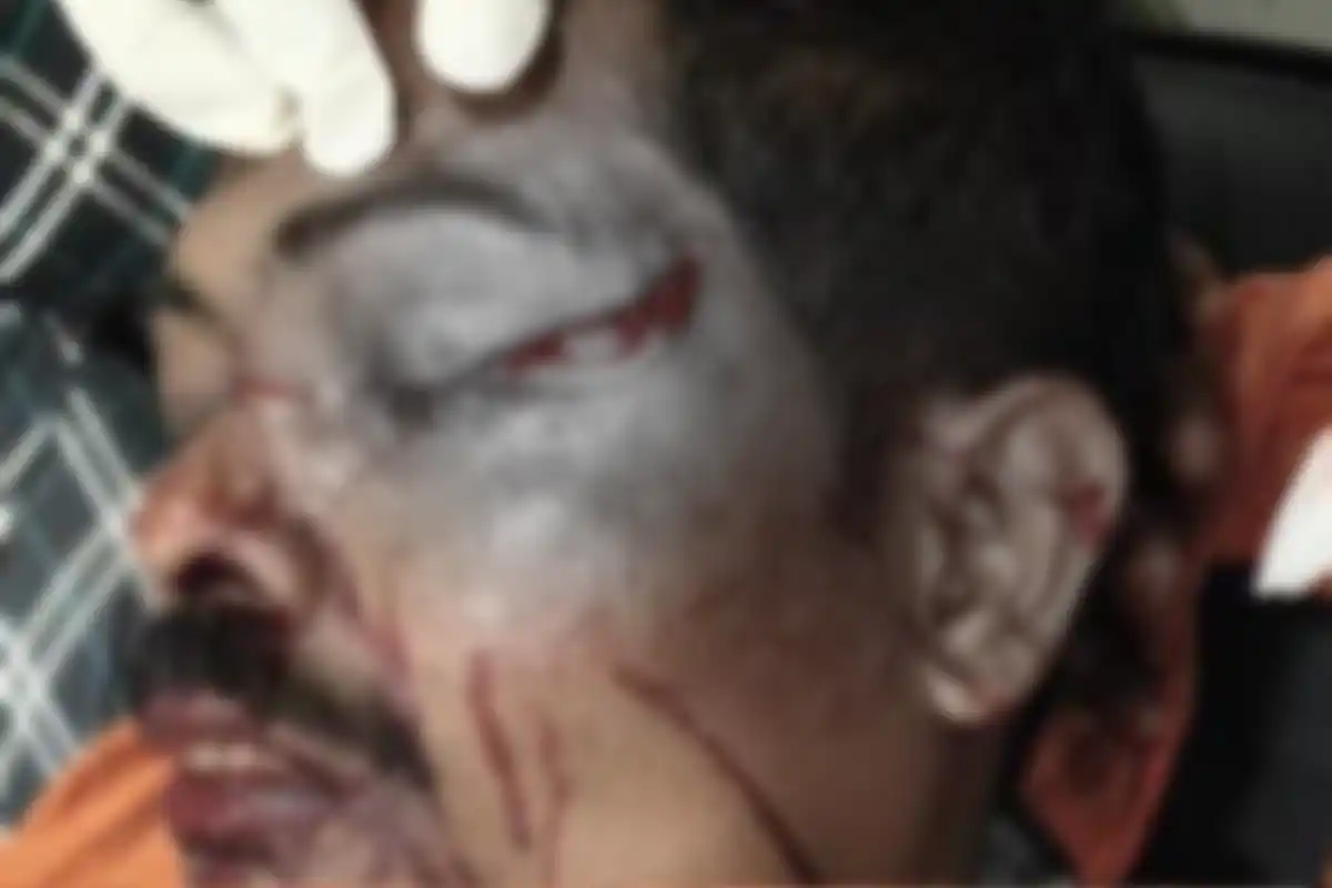 Chinese Manja Accident Hingoli: हिंगोली में चीनी मांजे से एक व्यक्ति घायल, प्रशासनिक लापरवाही उजागर