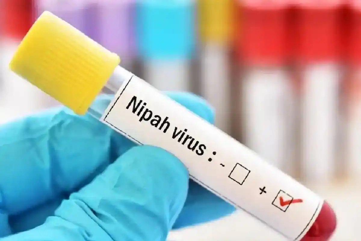 Nipah virus Outbreak: म्यांमार ने यांगून एयरपोर्ट पर बढ़ाई स्वास्थ्य जांच, भारत से यात्रियों की विशेष निगरानी
