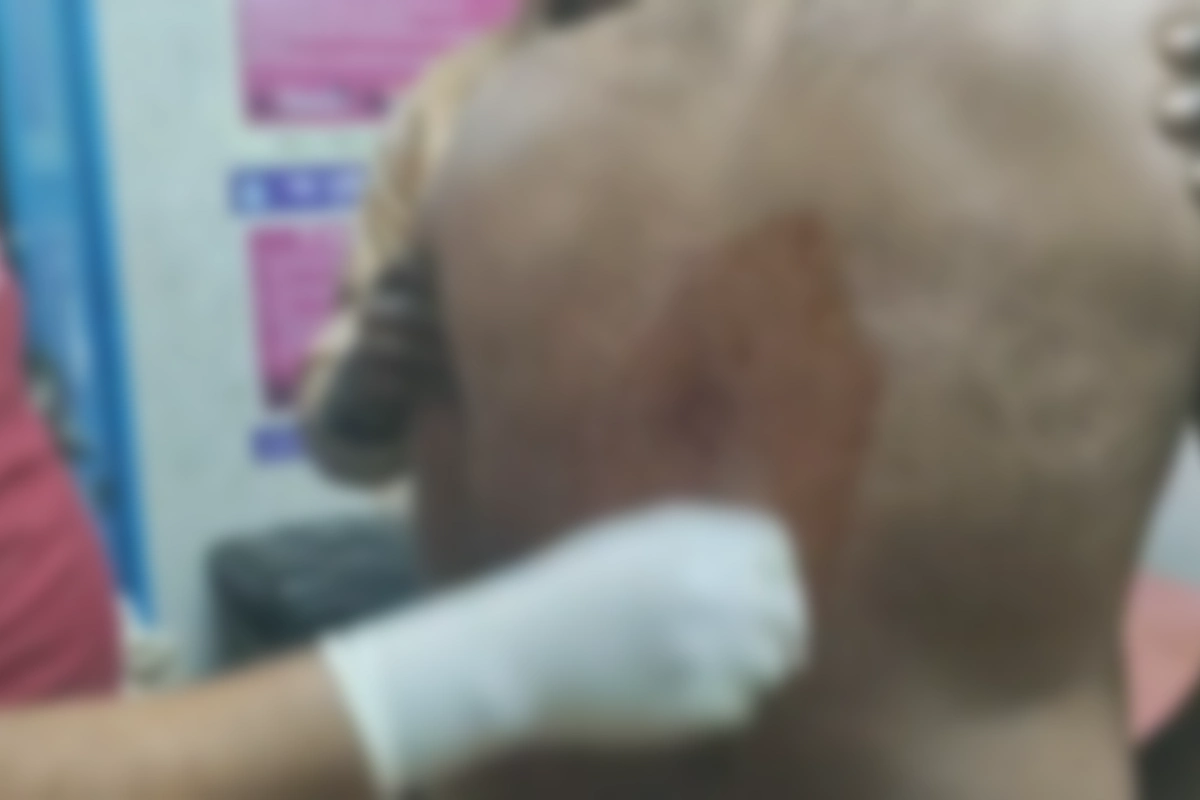 Kolkata Basanti Gold Trader, Kartik Naskar Shot, Hospitalised: आमझाड़ा में सुनार कार्तिक नस्कर पर गोलीबारी, छिनतई की आशंका में पुलिस जांच जारी | Photo: RB