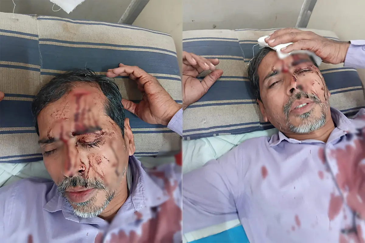 Attack on Nagpur Kidwai High School Teacher: नागपुर में शिक्षक पर जानलेवा हमला, मुख्याध्यापक पर पैसे मांगने का आरोप