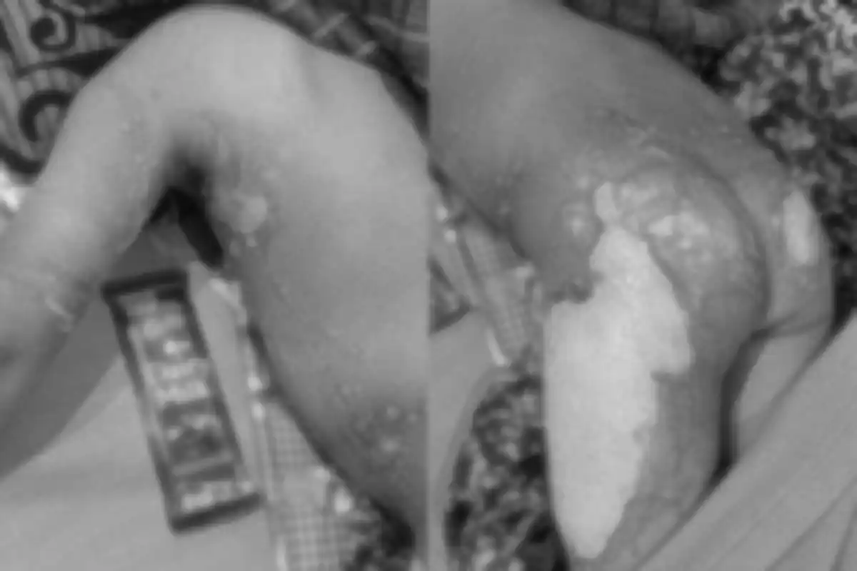 Nagpur Holi Incident: होली के दौरान 5 साल के बच्चे पर गर्म पानी फेंकने का मामला, 25% शरीर झुलसा 12 Nagpur Holi Incident, 5 Year Old Child Burned: होली पर 5 साल के बच्चे पर गर्म पानी फेंका, 25% शरीर झुलसा | कोराडी घटना (Image Source: RB / Jassi)