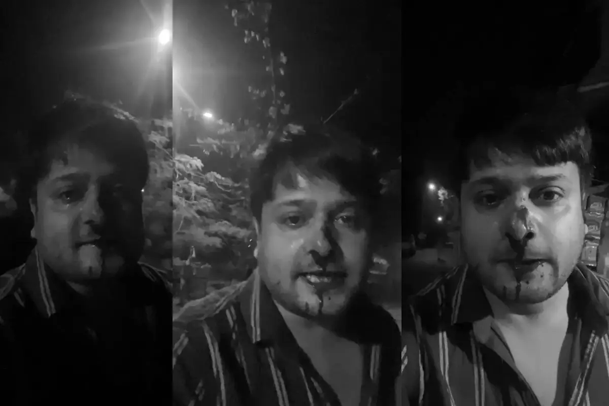 Durgapur T20 celebration violence : दुर्गापुर में भारत की जीत का जश्न मनाते समय शब्दबाजी को लेकर विवाद हुआ, जिसमें एक युवक को ईंट से मारकर घायल कर दिया गया और उसे अस्पताल में भर्ती कराया गया।